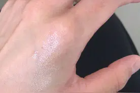 开水烫伤正确的处理方法。不起泡，不红肿。看到请收藏图片