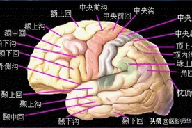 头颅（CT）解剖--精品图集图片