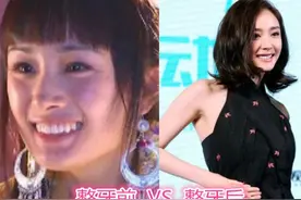 女星整牙前VS后，杨幂显瘦，baby成女神，看到杨紫很意外图片