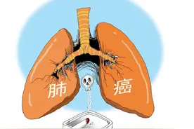 为何“癌症”越来越多？建议：坚持2件事，癌细胞离你越来越远图片