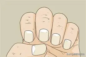 为什么有的人指甲上有月牙，有的人却没有？图片