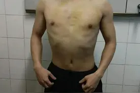 健身教练胸痛为哪般？图片