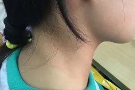 男子每天玩6小时手机，会发生什么？图片