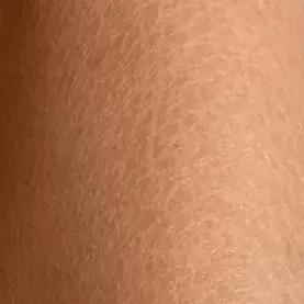 野脚鸡皮肤穿裙子 野脚鸡皮肤穿裙子