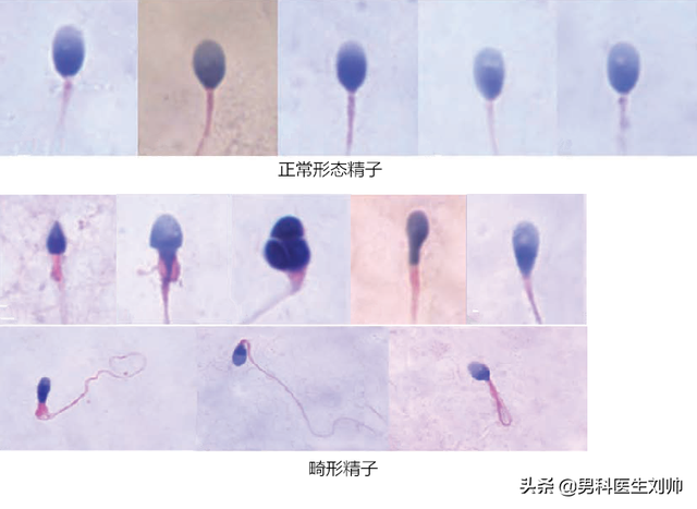 男性科普：精液检查