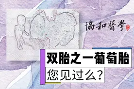 极为罕见！怀了双胞胎，却有一个是葡萄胎？高龄宝妈葡萄胎16周成功引产于阴道分娩图片