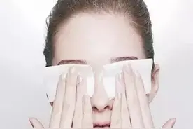 双眼皮术后长期未消肿，是失败了吗？图片