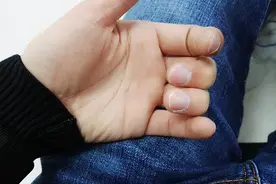 每天早上起床后，双手发胀，五指握不紧，是怎么回事？图片