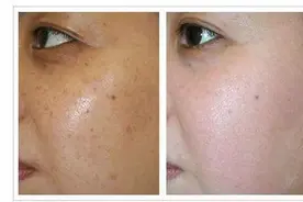 脸上暗沉无光泽特别蜡黄怎么办？这些有关提亮肤色的技巧记得收藏图片