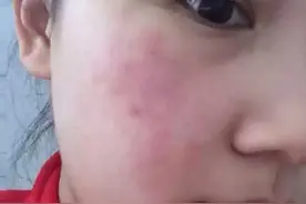 化妆品中的常见过敏源，早些了解就能少踩坑图片