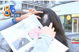 被手工耿开心挠挠椅卡住头发，姑娘秃了一块图片