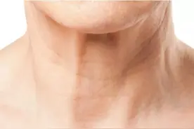颈纹问题，连女明星都难逃一死的缺点，今天给你们一次讲清楚图片