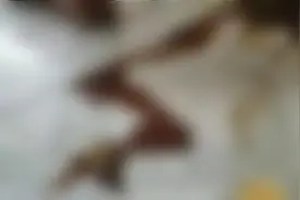 少年凌晨两点大口呕吐鲜血，家校协力抗病魔图片