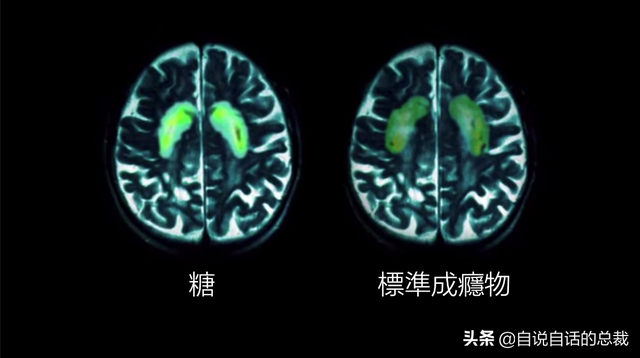 糖：最甜蜜的杀手，成瘾性极强？我们为什么无法戒糖…