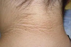 怀孕后，孕妇身体这5处位置会变黑，不要怕，越黑代表胎儿越健康图片