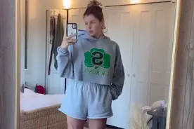 外国女孩倒计时记录自己截肢手术前后的画面… 好乐观好坚强图片