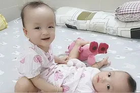 越南13个月大连体双胞胎分离成功，百名医生上阵，手术12小时图片