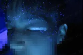 白癜风年轻化，青少年眼周长有白癜风，会不会影响视力图片