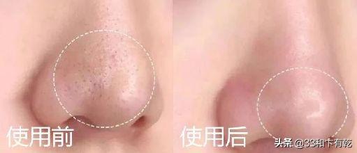 火爆INS的芝士皂，洗脸就像敷面膜，痘痘，黑头，螨虫全都消失了