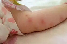 跟蚊子作战9年，这几种驱蚊方法最安全+最有效，学会让孩子少遭罪图片