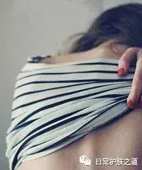 去鸡皮疙瘩好用的香皂