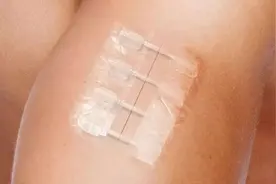 “超级胶带”告别缝针痛苦，伤口能快速愈合，将进入中国市场视频封面