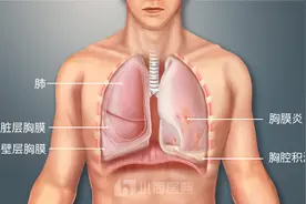 胸膜炎疼痛位置图片