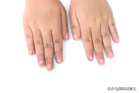 “指甲软是缺钙？有白点是有蛔虫？”说说关于宝宝指甲的那些事图片