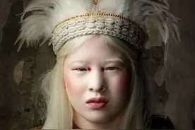 白化病女孩变身时尚模特！中国女孩雪莉，是如何走上国际舞台的图片