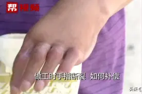 做工时不慎将手掌压断，赔偿金额却迟迟没谈拢图片
