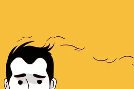 二十多岁就“地中海”了，我挣扎了几年还是选择了植发图片