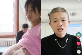 贵州巨肚妈妈重获新生，要感谢谁？是网络的强大，还是医疗的发达图片
