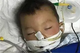 2岁男童误喝一口502胶水，奶奶迅速做出反应，被医生连连称赞图片