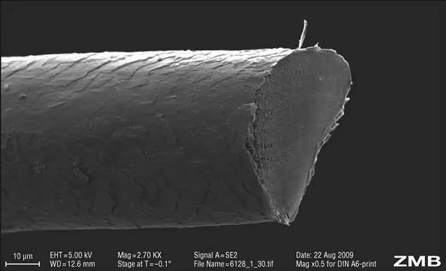 得了毛襄角化症的人能结婚吗