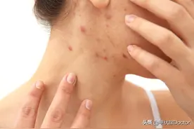 药物滥用下：慎用这8类对甲状腺有伤害的药物，很多人都忽视了图片
