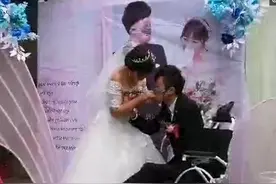 新郎被大火毁容失去了手臂，用嘴巴“亲口”为新娘戴上结婚戒指图片