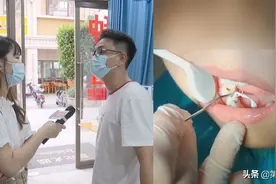 工业塑料竟用于牙齿治疗？已有儿童牙齿发炎，这些诊所也这样做图片