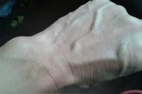 为啥有人手上会青筋暴起？不仅不好看，青筋越多，其实健康越差？图片
