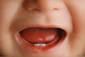 宝宝什么时候出牙才正常？出牙前会出现这几个信号，家长别忽略图片