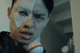 突然面瘫！35岁男星宣布全面停工接受治疗，后悔没重视早期症状图片