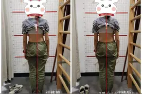 孩子体态不好不只有含胸驼背，千万别忽略了骨盆问题图片