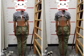 孩子体态不好不只有含胸驼背，千万别忽略了骨盆问题图片
