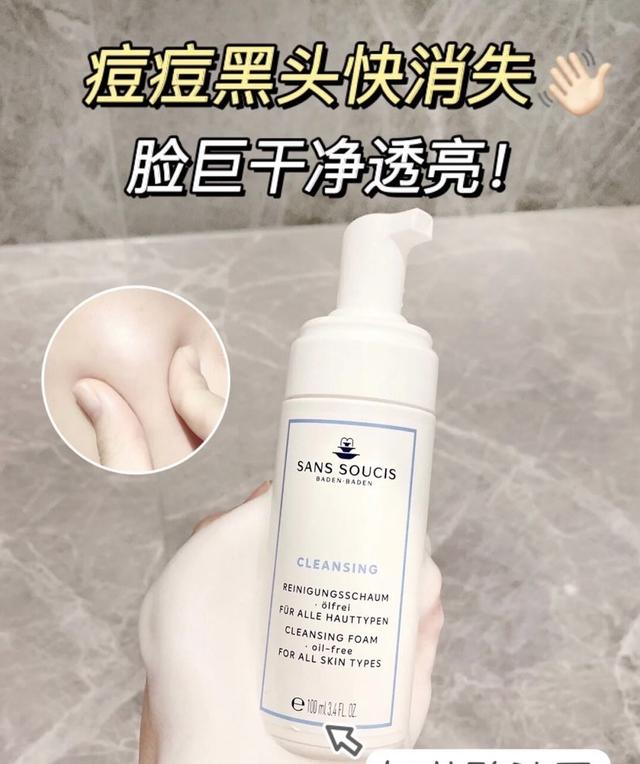 油痘肌的福音来啦！痘痘闭口快跑掉