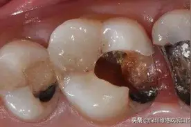 你的口腔都存在哪些疾病图片