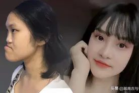 越南丑女因脸部畸形被戏称为“外星人”，为改变外貌，整容成美女图片