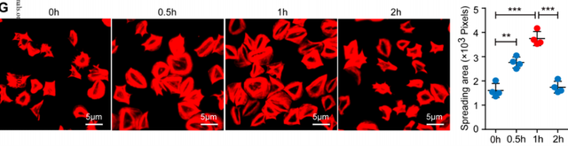 增肌不成反伤身，支链氨基酸补充剂竟然有害