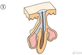 讨厌的黑头全滚开，薛大夫告诉你黑头到底是啥？图片