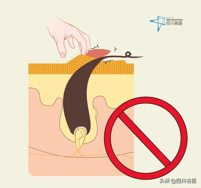 鸡皮肤真的不能消除吗