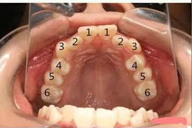 「家长注意了」口腔里面比黄金都珍贵的是哪颗牙齿？你知道吗？图片