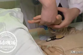 19岁乖巧女孩突然胡言乱语，详细检查发现原因！图片